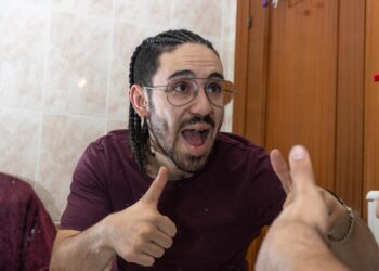 Saçları örgülü, gözlüklü bir adam şaşkınlıkla ellerini kaldırarak gülümserken görünüyor.